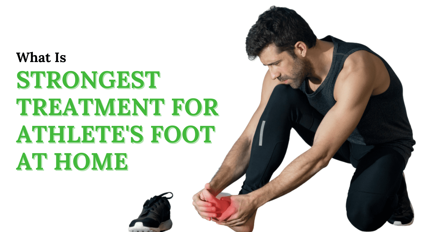 what is the strongest treatment for athlete's foot at home