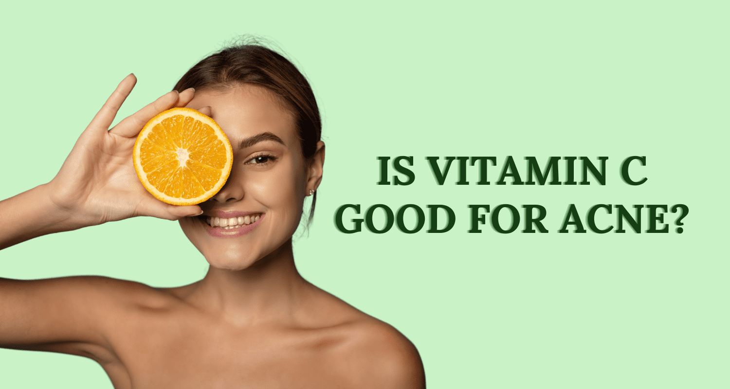 is vitamin c good for acne